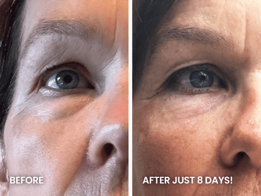 Photograph of a woman's right eye and surrounding skin, split into two vertical panels for a "before and after" comparison. The left panel, labeled "BEFORE", shows visible wrinkles and fine lines around the eye, particularly under it and at the outer corner, with some puffiness. The right panel, labeled "AFTER JUST 8 DAYS!", shows the same eye with significantly reduced wrinkles and fine lines, and smoother, less puffy skin under the eye.